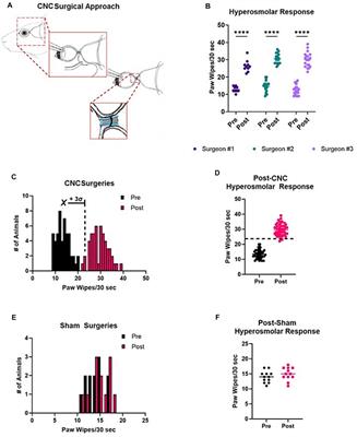 A novel animal model of neuropathic corneal pain–the ciliary nerve constriction model